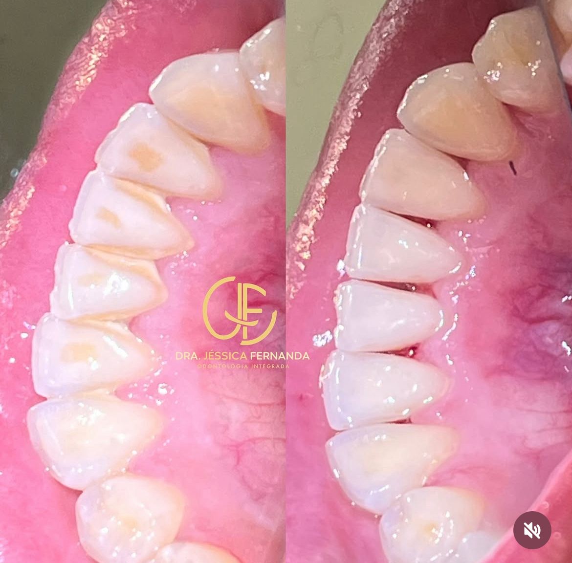 Prevenção odontológica